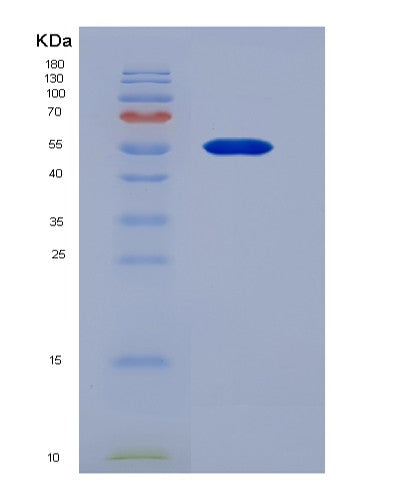 SDS-PAGE analysis of Human WARS1 (Tryptophan--Trna Ligase, Cytoplasmic) - Recombinant Protein, showing >95% purity under 15% SDS-PAGE (Reduced)