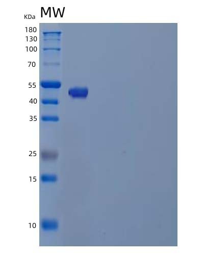 SDS-PAGE analysis of Human TUBB4A (Tubulin Beta-4A Chain) - Recombinant Protein, showing >90% purity under 15% SDS-PAGE (Reduced)