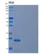 SDS-PAGE analysis of Mouse Il21 (Interleukin-21) - Recombinant Protein, showing >85% purity under 15% SDS-PAGE (Reduced)