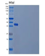 SDS-PAGE analysis of Human UBE2J2 (Ubiquitin-Conjugating Enzyme E2 J2) - Recombinant Protein, showing >85% purity under 15% SDS-PAGE (Reduced)