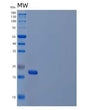 SDS-PAGE analysis of Human IL20 (Interleukin-20) - Recombinant Protein, showing >90% purity under 15% SDS-PAGE (Reduced)