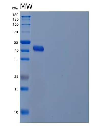 SDS-PAGE analysis of Human ADH7 (All-Trans-Retinol Dehydrogenase [Nad(+)] Adh7) - Recombinant Protein, showing >85% purity under 15% SDS-PAGE (Reduced)