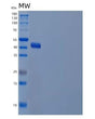 SDS-PAGE analysis of Human ADH7 (All-Trans-Retinol Dehydrogenase [Nad(+)] Adh7) - Recombinant Protein, showing >85% purity under 15% SDS-PAGE (Reduced)