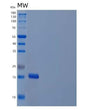SDS-PAGE analysis of Human IL21 (Interleukin-21) - Recombinant Protein, showing >95% purity under 15% SDS-PAGE (Reduced)