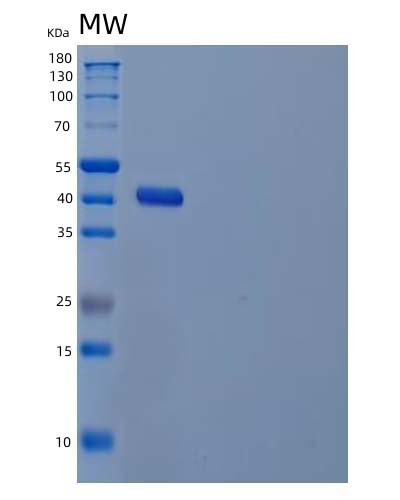 SDS-PAGE analysis of Human GALE (Udp-Glucose 4-Epimerase) - Recombinant Protein, showing >90% purity under 15% SDS-PAGE (Reduced)