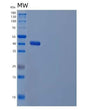 SDS-PAGE analysis of Human GALE (Udp-Glucose 4-Epimerase) - Recombinant Protein, showing >90% purity under 15% SDS-PAGE (Reduced)