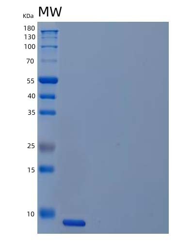 SDS-PAGE analysis of Human UCMA (Unique Cartilage Matrix-Associated Protein) - Recombinant Protein, showing >95% purity under 15% SDS-PAGE (Reduced)
