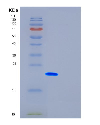 SDS-PAGE analysis of Human FTH1 (Ferritin Heavy Chain) - Recombinant Protein, showing >85% purity under 15% SDS-PAGE (Reduced)