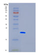 SDS-PAGE analysis of Human FTH1 (Ferritin Heavy Chain) - Recombinant Protein, showing >85% purity under 15% SDS-PAGE (Reduced)
