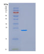 SDS-PAGE analysis of Human MRM2 (Rrna Methyltransferase 2, Mitochondrial) - Recombinant Protein, showing >90% purity under 15% SDS-PAGE (Reduced)