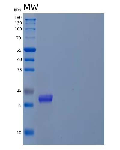 SDS-PAGE analysis of Human PFDN4 (Prefoldin Subunit 4) - Recombinant Protein, showing >90% purity under 15% SDS-PAGE (Reduced)