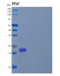 SDS-PAGE analysis of Human PFDN4 (Prefoldin Subunit 4) - Recombinant Protein, showing >90% purity under 15% SDS-PAGE (Reduced)