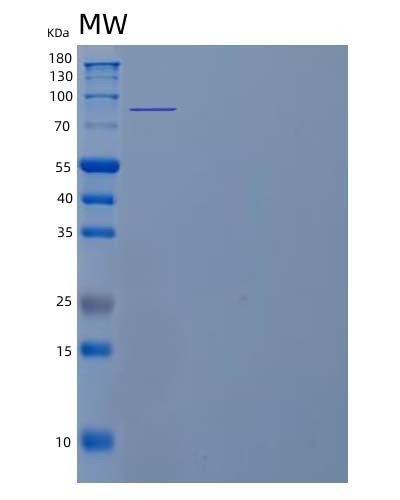 SDS-PAGE analysis of Human ACE2 (Angiotensin-Converting Enzyme 2) - Recombinant Protein, showing >95% purity under 15% SDS-PAGE (Reduced)