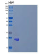 SDS-PAGE analysis of Human ZNF75A (Zinc Finger Protein 75A) - Recombinant Protein, showing >85% purity under 15% SDS-PAGE (Reduced)