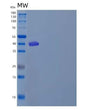 SDS-PAGE analysis of Human CD47 (Leukocyte Surface Antigen Cd47) - Recombinant Protein, showing >85% purity under 15% SDS-PAGE (Reduced)