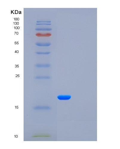 SDS-PAGE analysis of Human CSF3 (Granulocyte Colony-Stimulating Factor) - Recombinant Protein, showing >95% purity under 15% SDS-PAGE (Reduced)