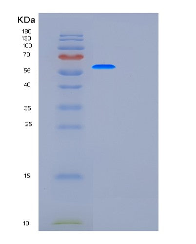 SDS-PAGE analysis of Human G6PD (Glucose-6-Phosphate 1-Dehydrogenase) - Recombinant Protein, showing >90% purity under 15% SDS-PAGE (Reduced)