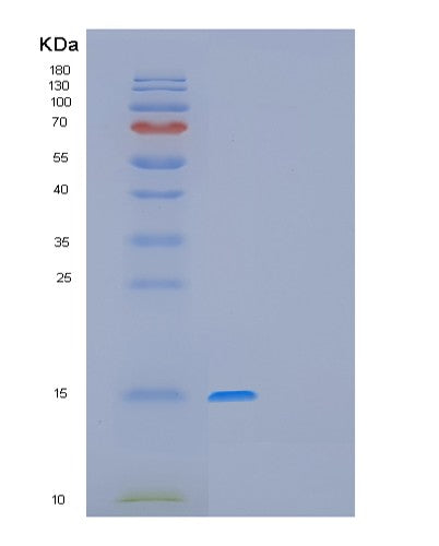 SDS-PAGE analysis of Human GAGE12F (G Antigen 12F) - Recombinant Protein, showing >95% purity under 15% SDS-PAGE (Reduced)