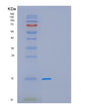 SDS-PAGE analysis of Human GAGE12F (G Antigen 12F) - Recombinant Protein, showing >95% purity under 15% SDS-PAGE (Reduced)