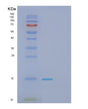 SDS-PAGE analysis of Human GAGE2A (G Antigen 2A) - Recombinant Protein, showing >90% purity under 15% SDS-PAGE (Reduced)