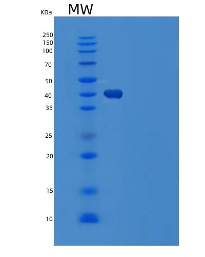 SDS-PAGE analysis of Mouse Lgmn (Legumain) - Recombinant Protein, showing >90% purity under 15% SDS-PAGE (Reduced)