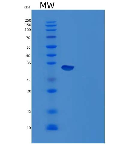 SDS-PAGE analysis of Mouse Ca12 (Carbonic Anhydrase 12) - Recombinant Protein, showing >95% purity under 15% SDS-PAGE (Reduced)