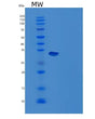 SDS-PAGE analysis of Mouse Ca12 (Carbonic Anhydrase 12) - Recombinant Protein, showing >95% purity under 15% SDS-PAGE (Reduced)