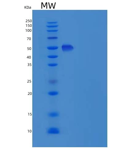 SDS-PAGE analysis of Mouse Icam2 (Intercellular Adhesion Molecule 2) - Recombinant Protein, showing >90% purity under 15% SDS-PAGE (Reduced)