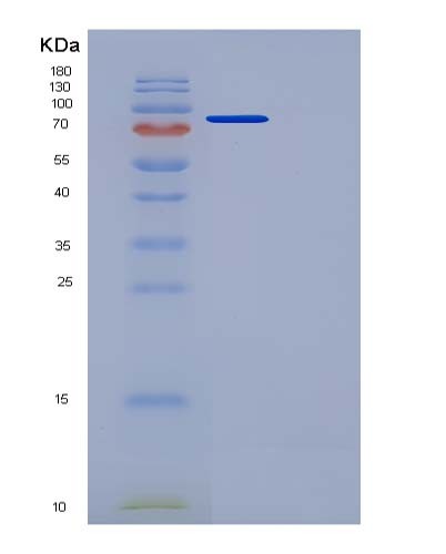 SDS-PAGE analysis of Mouse Sema3a (Semaphorin-3A) - Recombinant Protein, showing >95% purity under 15% SDS-PAGE (Reduced)