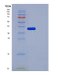 SDS-PAGE analysis of Human AKR1A1 (Aldo-Keto Reductase Family 1 Member A1) - Recombinant Protein, showing >95% purity under 15% SDS-PAGE (Reduced)