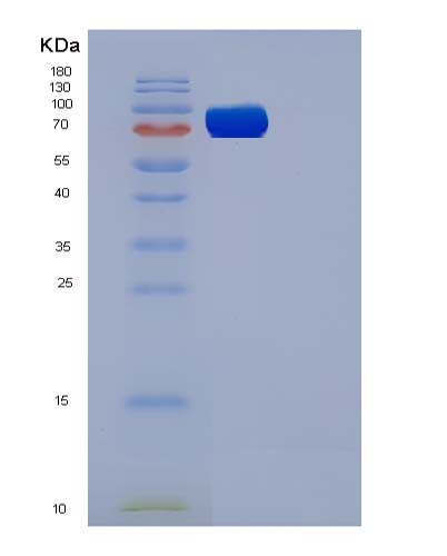 SDS-PAGE analysis of Mouse Flt4 (Vascular Endothelial Growth Factor Receptor 3) - Recombinant Protein, showing >85% purity under 15% SDS-PAGE (Reduced)