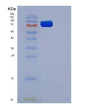 SDS-PAGE analysis of Mouse Flt4 (Vascular Endothelial Growth Factor Receptor 3) - Recombinant Protein, showing >85% purity under 15% SDS-PAGE (Reduced)