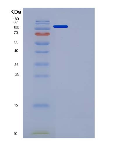 SDS-PAGE analysis of Mouse Flt4 (Vascular Endothelial Growth Factor Receptor 3) - Recombinant Protein, showing >95% purity under 15% SDS-PAGE (Reduced)