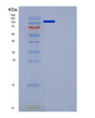 SDS-PAGE analysis of Mouse Flt4 (Vascular Endothelial Growth Factor Receptor 3) - Recombinant Protein, showing >95% purity under 15% SDS-PAGE (Reduced)