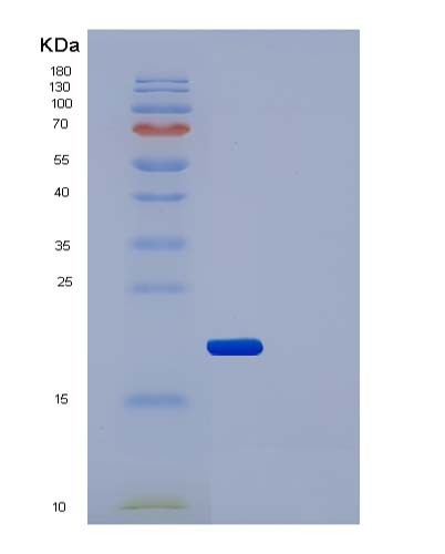 SDS-PAGE analysis of Human IL2RA (Interleukin-2 Receptor Subunit Alpha) - Recombinant Protein, showing >90% purity under 15% SDS-PAGE (Reduced)