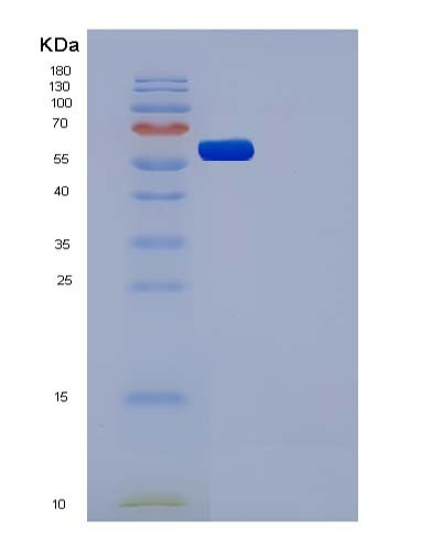 SDS-PAGE analysis of Human CSF1R (Macrophage Colony-Stimulating Factor 1 Receptor) - Recombinant Protein, showing >85% purity under 15% SDS-PAGE (Reduced)