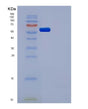 SDS-PAGE analysis of Human CSF1R (Macrophage Colony-Stimulating Factor 1 Receptor) - Recombinant Protein, showing >85% purity under 15% SDS-PAGE (Reduced)