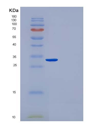 SDS-PAGE analysis of Human CUTC (Copper Homeostasis Protein Cutc Homolog) - Recombinant Protein, showing >90% purity under 15% SDS-PAGE (Reduced)