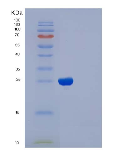 SDS-PAGE analysis of Human IL2RB (Interleukin-2 Receptor Subunit Beta) - Recombinant Protein, showing >85% purity under 15% SDS-PAGE (Reduced)