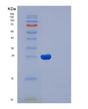SDS-PAGE analysis of Human IL2RB (Interleukin-2 Receptor Subunit Beta) - Recombinant Protein, showing >85% purity under 15% SDS-PAGE (Reduced)