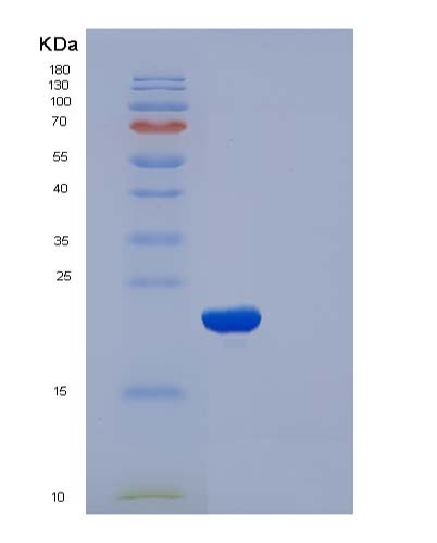 SDS-PAGE analysis of Human CFL2 (Cofilin-2) - Recombinant Protein, showing >90% purity under 15% SDS-PAGE (Reduced)