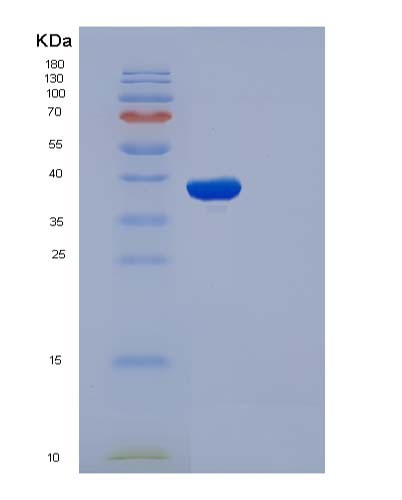 SDS-PAGE analysis of Human SELENOP (Selenoprotein P) - Recombinant Protein, showing >90% purity under 15% SDS-PAGE (Reduced)