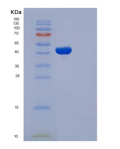 SDS-PAGE analysis of Human MAX (Protein Max) - Recombinant Protein, showing >90% purity under 15% SDS-PAGE (Reduced)