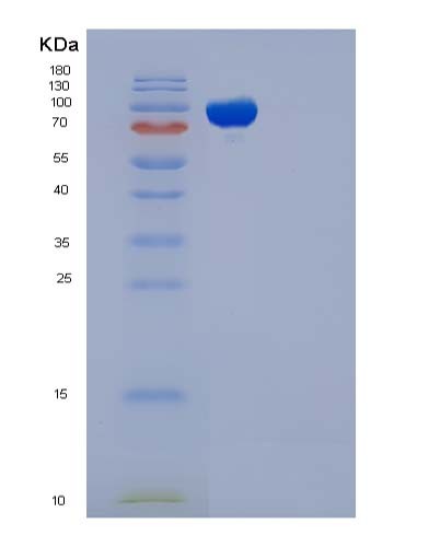 SDS-PAGE analysis of Human EED (Polycomb Protein Eed) - Recombinant Protein, showing >90% purity under 15% SDS-PAGE (Reduced)