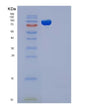 SDS-PAGE analysis of Human EED (Polycomb Protein Eed) - Recombinant Protein, showing >90% purity under 15% SDS-PAGE (Reduced)