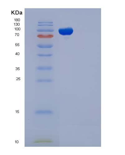 SDS-PAGE analysis of Mouse Icam1 (Intercellular Adhesion Molecule 1) - Recombinant Protein, showing >90% purity under 15% SDS-PAGE (Reduced)