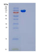 SDS-PAGE analysis of Mouse Icam1 (Intercellular Adhesion Molecule 1) - Recombinant Protein, showing >90% purity under 15% SDS-PAGE (Reduced)