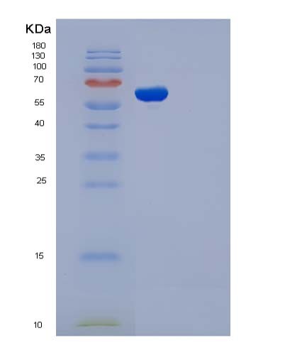 SDS-PAGE analysis of Human ADSL (Adenylosuccinate Lyase) - Recombinant Protein, showing >85% purity under 15% SDS-PAGE (Reduced)