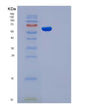 SDS-PAGE analysis of Human ADSL (Adenylosuccinate Lyase) - Recombinant Protein, showing >85% purity under 15% SDS-PAGE (Reduced)