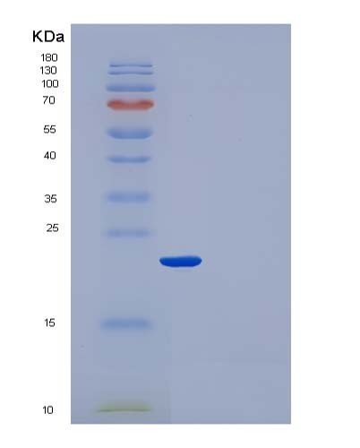 SDS-PAGE analysis of Human CRP (C-Reactive Protein) - Recombinant Protein, showing >95% purity under 15% SDS-PAGE (Reduced)